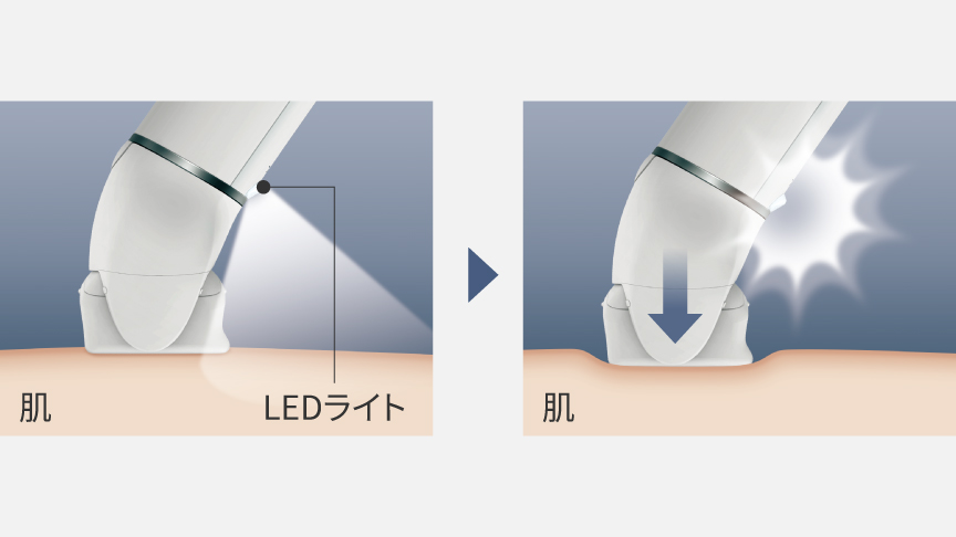 ES-EY4AとES-EL4Bの違いは5つだった！パナソニック脱毛器ソイエ比較