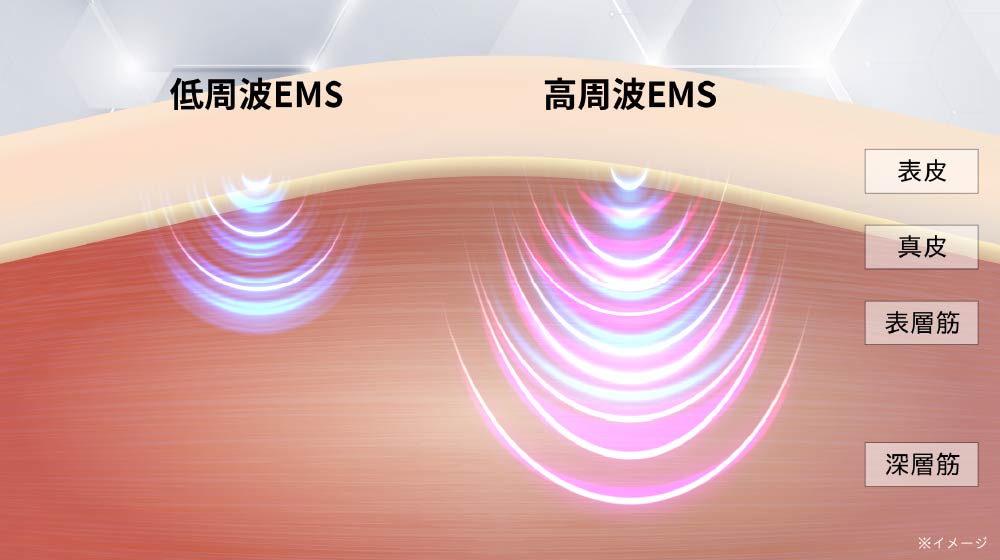 フォトプラスシャイニーネオの口コミレビュー！効果や使い方は？ヤーマン