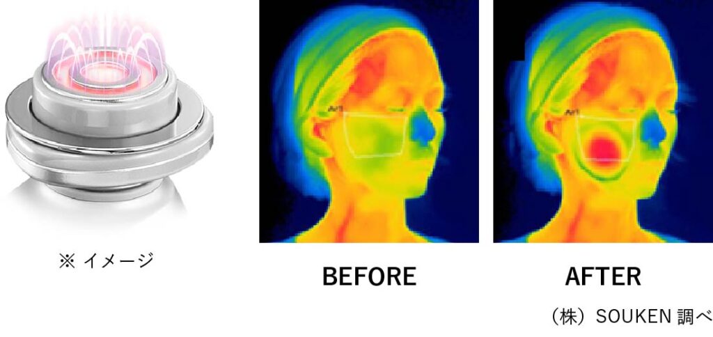 フォトプラスシャイニーとネオの違いは5つ！ヤーマンRF美顔器比較