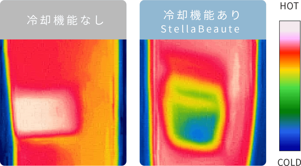 ステラボーテIPL&LED光美容器とIPL光美容器の違いを比較したら５つだった